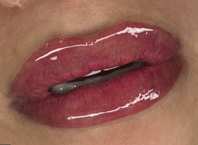 El Poder de una Sonrisa: Pigmentación de Labios 💋💖